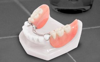 Зубные протезы: Как новые материалы обеспечивают комфорт и естественность