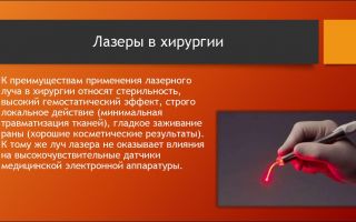 Дазия: Удивительное создание в мире животных