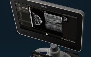 Характеристики аппарата УЗИ «PHILIPS AFFINITI 50»