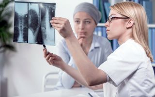 Лычас трикаринатус: загадочный подводный мир