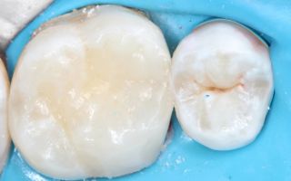 Ирминея паук птицеед: величественный хищник тропических лесов