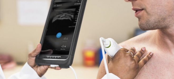 Революция в ультразвуковой диагностике с Lumify