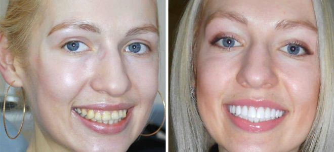 Узнайте все о гусенице-дереве: Heteropteryx dilatata — искусство маскировки в животном мире