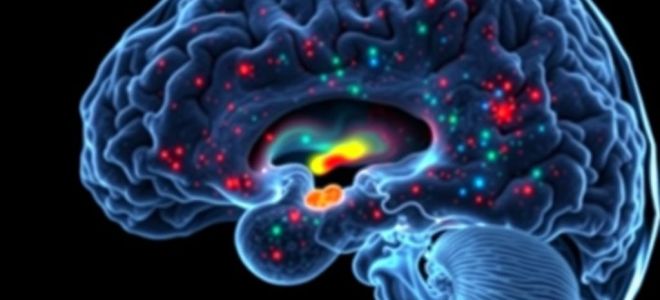 Опухоль глиального ряда: что это, как распознать и с чем бороться