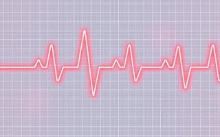 Холтеровское мониторирование: как поймать аритмию, которая прячется