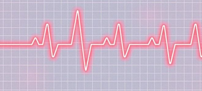 Холтеровское мониторирование: как поймать аритмию, которая прячется