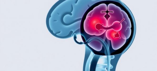 После удара: как лечат и восстанавливают жизнь после ишемического и геморрагического инсульта