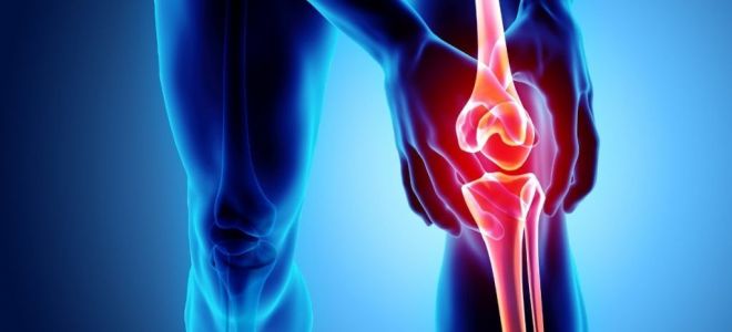 Понимаем причины и лечим артроз коленного сустава: симптомы, диагностика и методы терапии