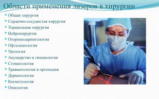 Хирургические лазеры: виды, описание и применение
